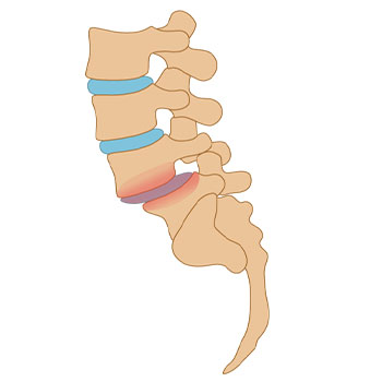 chiropractic adjustment is applied to the spine