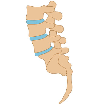 mislaignments in spine return to proper position